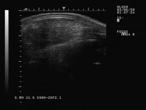 Carcass Ultrasound Ribeye